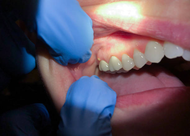 Best Same-Day Emergency Dental Services in Mcchord Af, WA
